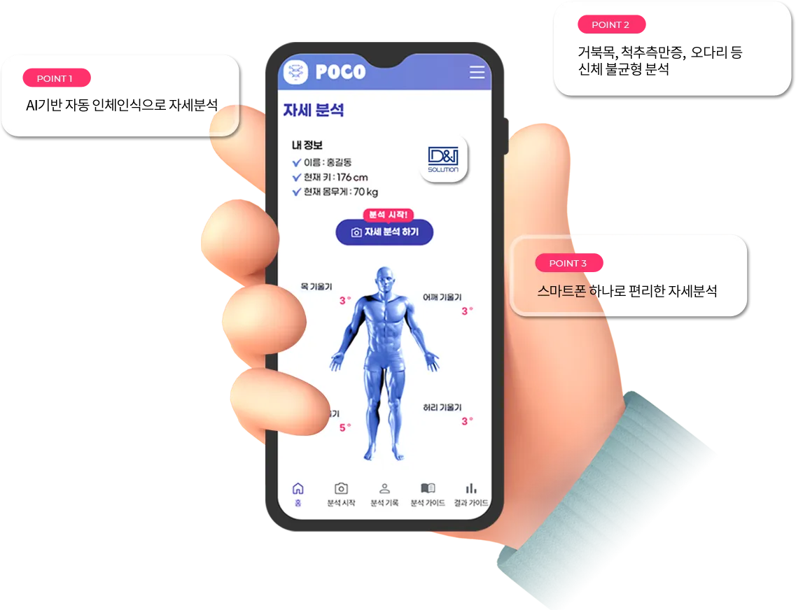 AI 기반 자세분석 앱 화면으로 인체 정렬과 관절 각도를 분석하는 모습