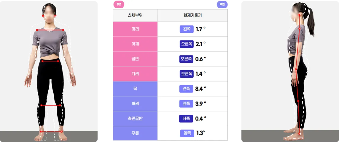 AI 자세분석을 통해 신체 부위별 각도와 정렬 상태를 분석한 결과 이미지