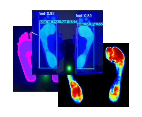 AI 알고리즘으로 분석된 족문 압력 데이터를 시각화한 화면